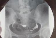 福州三代试管婴儿生殖医院排名，看完知道去哪家？